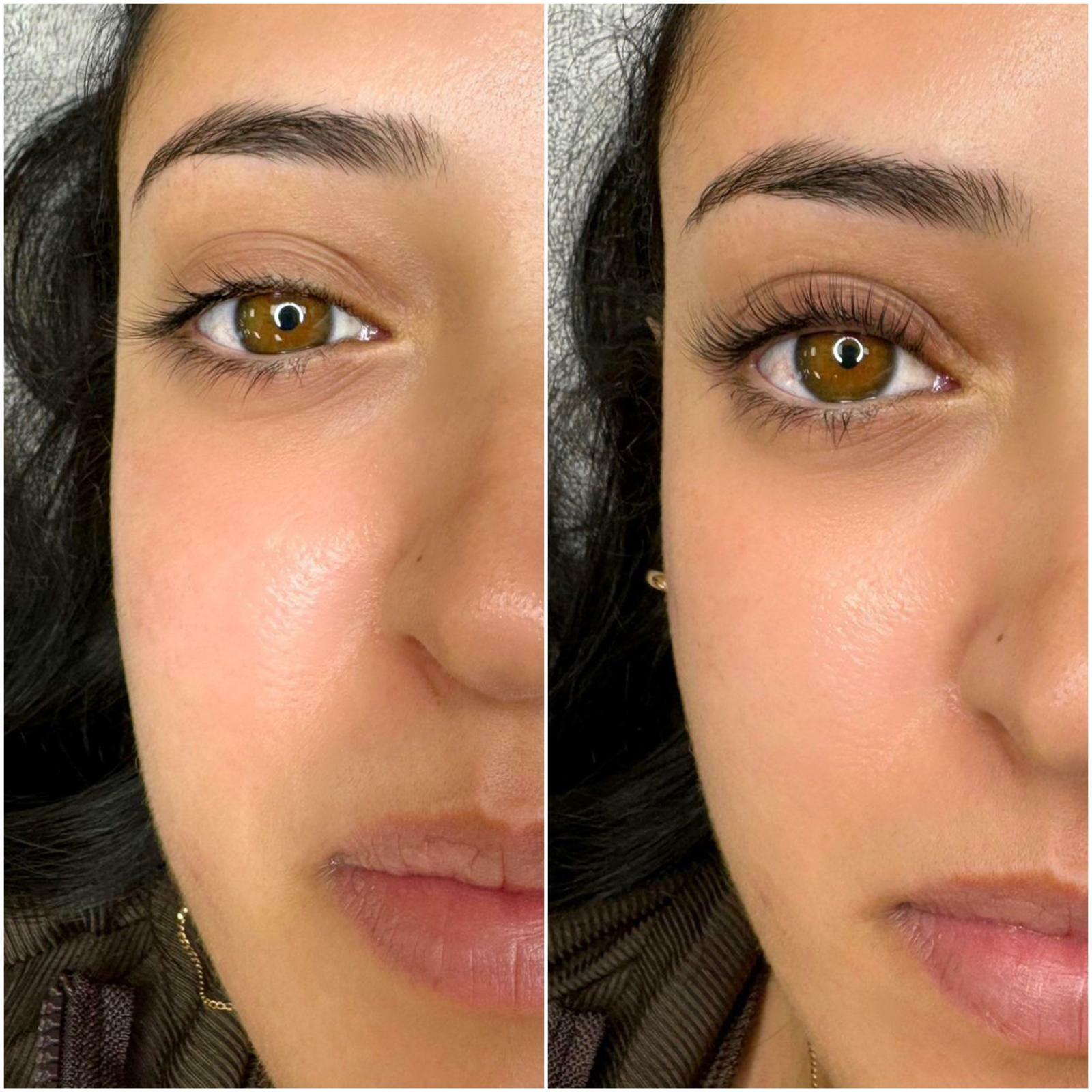 Lash Lift