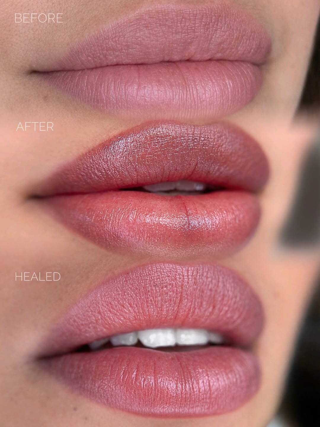 Lip blush before after