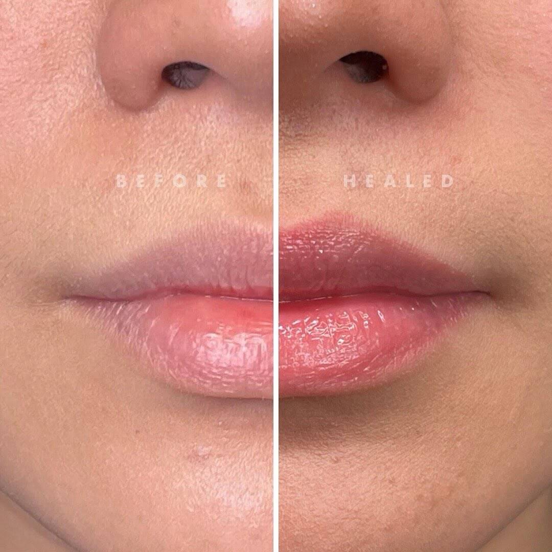 Lip blush before and after