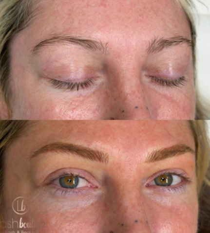 Before and after nano brows